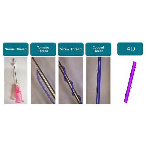 Screw Thread 30G / 38 mm With Needle